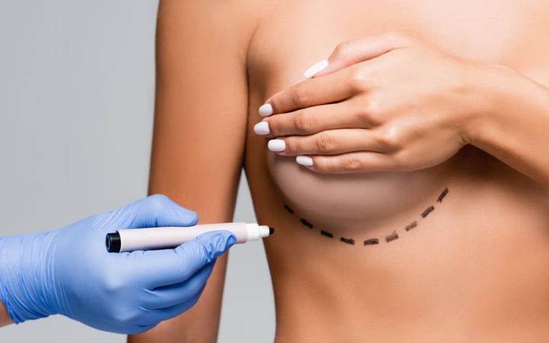 Reafirmación mamaria post embarazo: técnicas modernas sin cicatrices